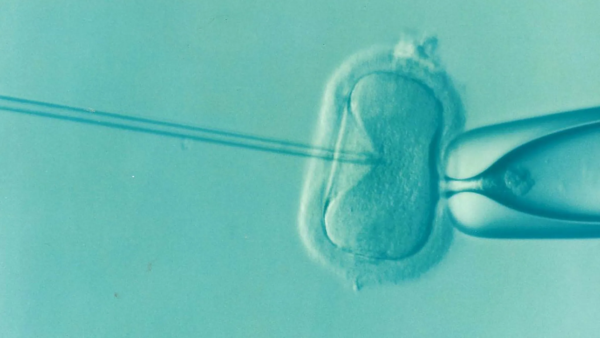 Fécondation in vitro (FIV) — prise en charge en PMA au centre de fertilité